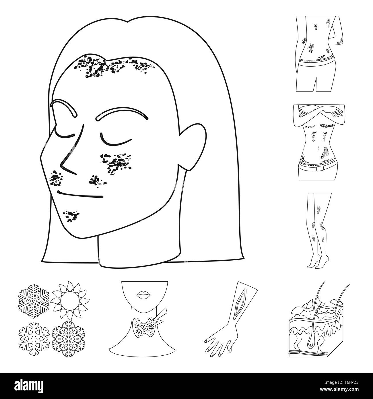 Psoriasis Snowflake Endocrine Injury Skin Body Falling System Arm Epidermis Stress Allergy Rash Infection Snow Anatomy Itch Peeling Chronic Snowfall Human Hand Pore Itchy Girl Frozen Thyroid Treatment Follicle Stomach Sun Hair Heat Disease Healthcare
