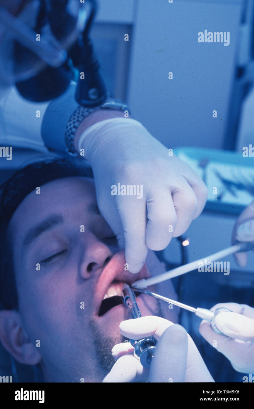 Dentist filling cavity Stock Photo Alamy