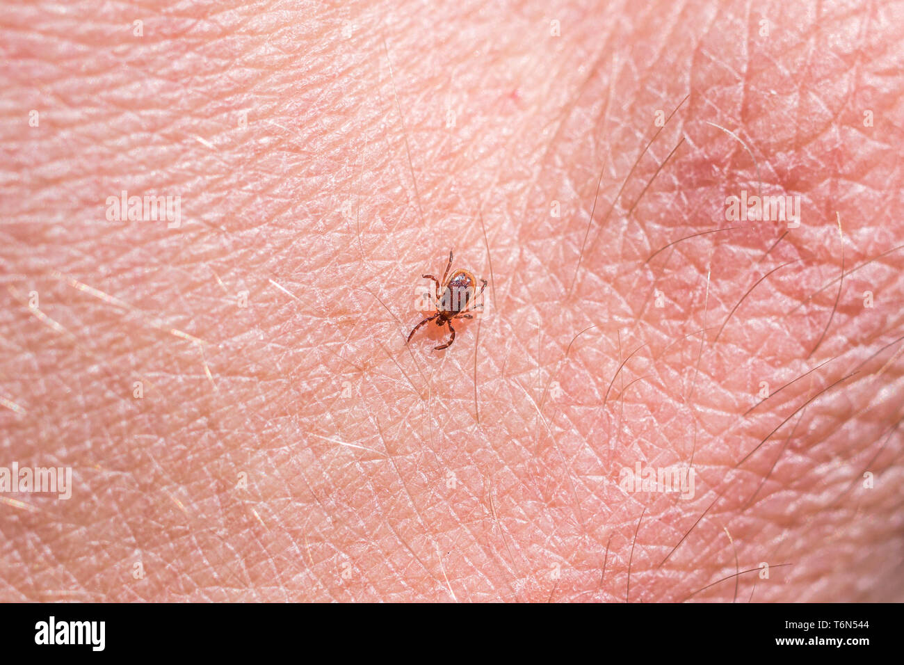 A deer tick or black-legged tick (Ixodes scapularis) crawling on skin. Stock Photo