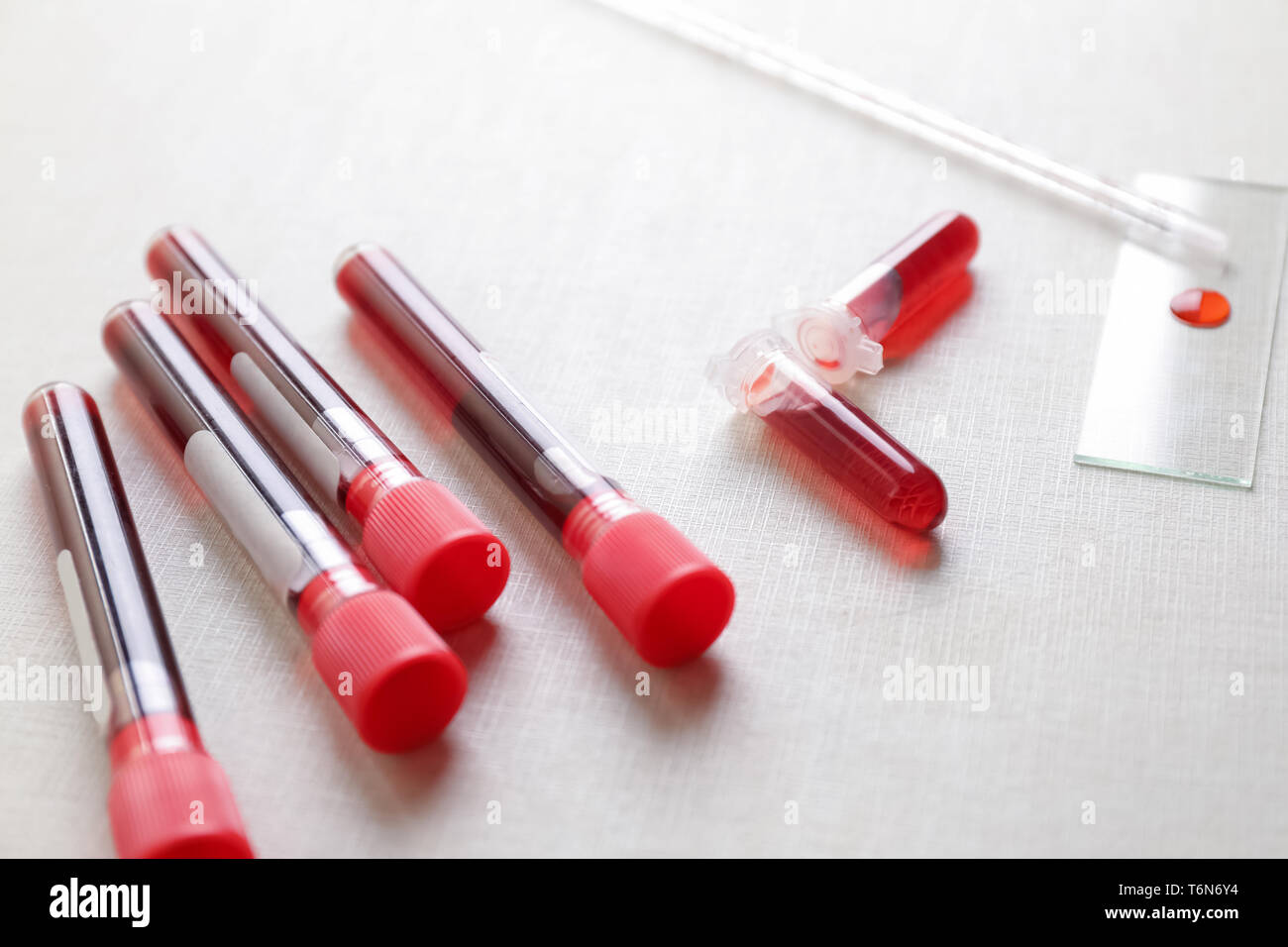 Glass and test tubes with blood samples on table Stock Photo - Alamy