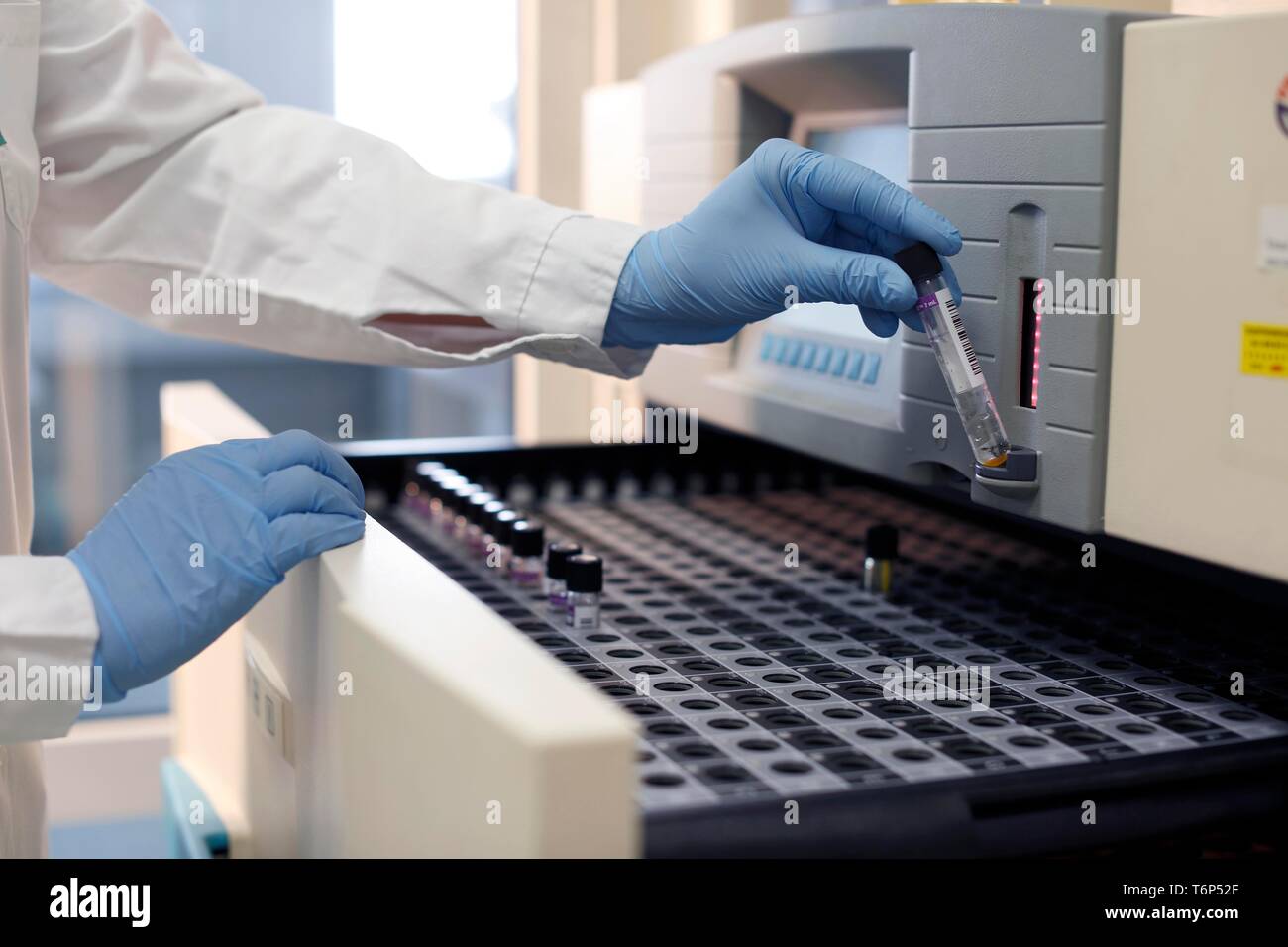 Laboratory testing for tuberculosis, laboratory, Karlovy Vary, Czech Republic Stock Photo Alamy