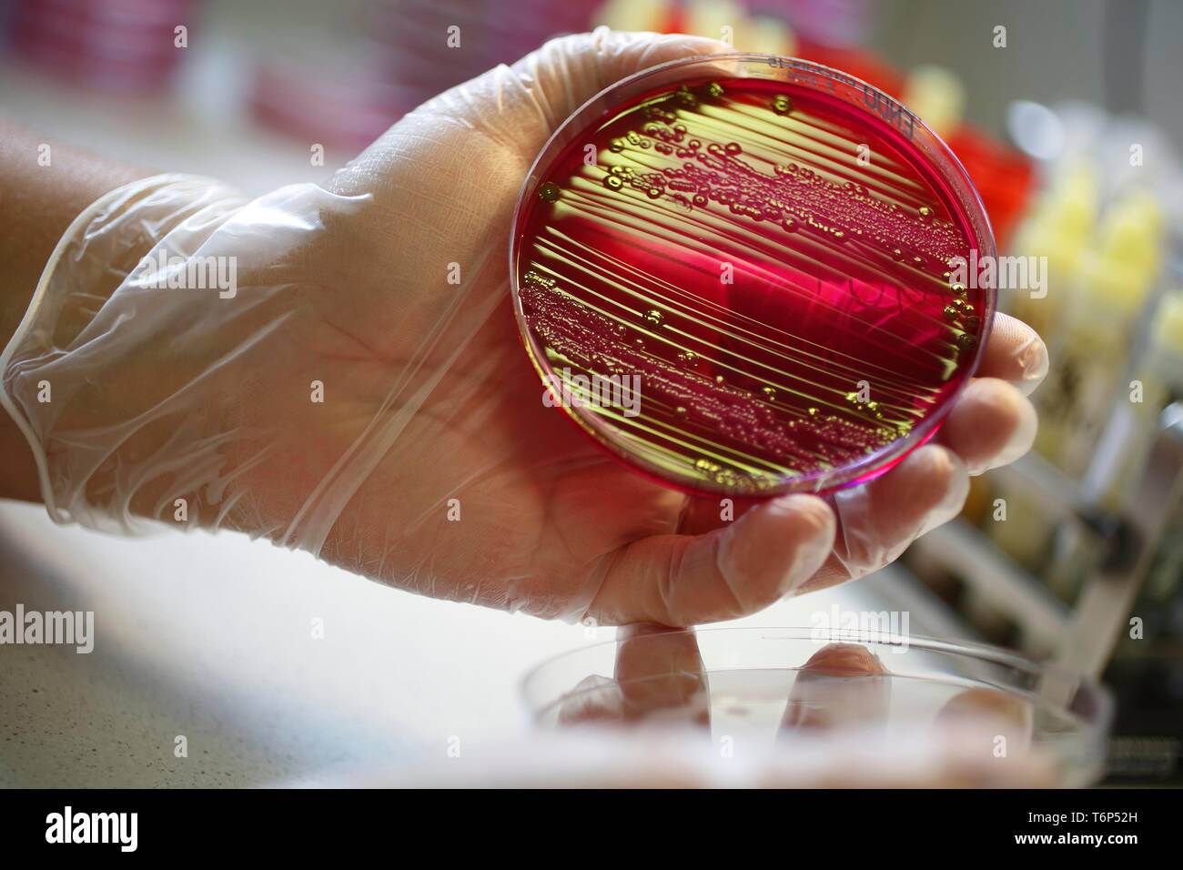 Petri dish with culture medium with bacterial cultures, medical