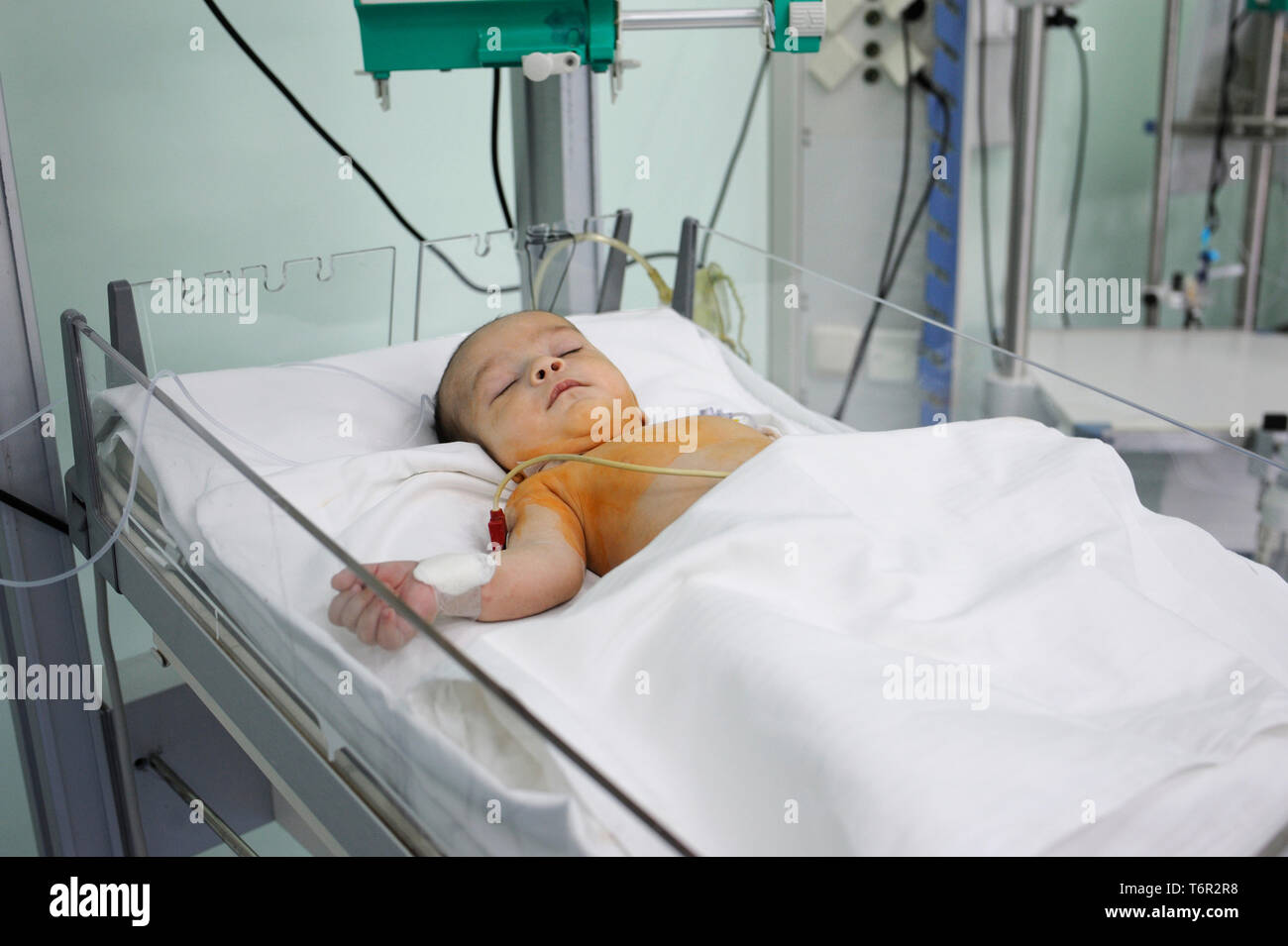 At the intensive care unit. Baby laying on a hospital bed and attached to a reviving apparatus. Children’s Cardiac Center. May 18,2018. Kiev,Ukraine Stock Photo