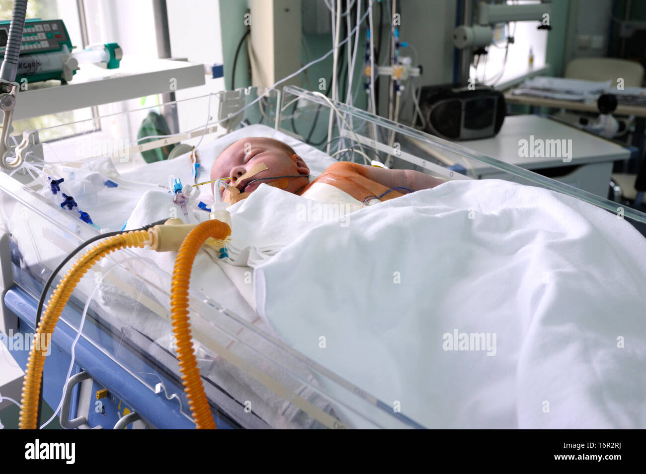 At the intensive care unit. Baby laying on a hospital bed and attached to a reviving apparatus. Children’s Cardiac Center. May 18,2018. Kiev,Ukraine Stock Photo