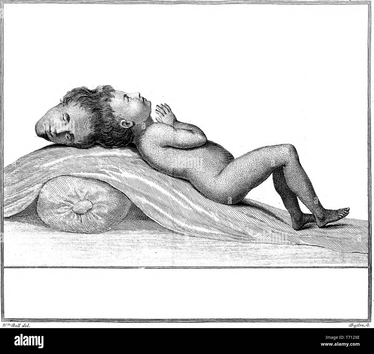 Black and white print depicting a child born with two heads (attached at the crown) at approximately twenty weeks old, resting with his eyes closed, in full-length profile, on a blanket draped over a pillow, published in Everard Home's 'An Account of a Child with a Double Head', 1790. Courtesy Internet Archive. () Stock Photo