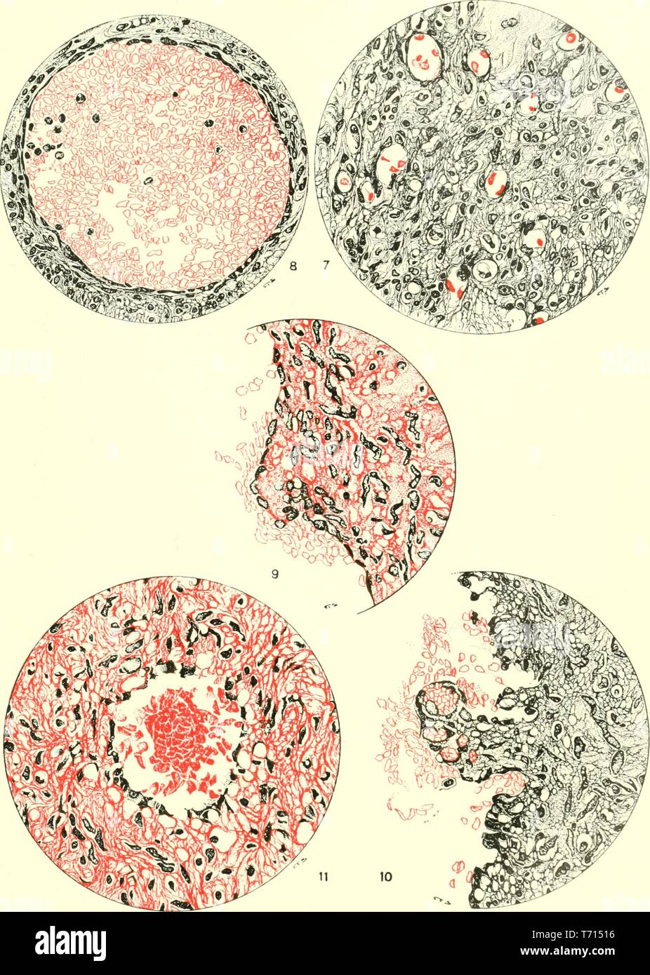 Illustrated engravings of changes in fetal vessels of the liver, from the book 'The American journal of anatomy' by Johns Hopkins University, 1914. Courtesy Internet Archive. () Stock Photo