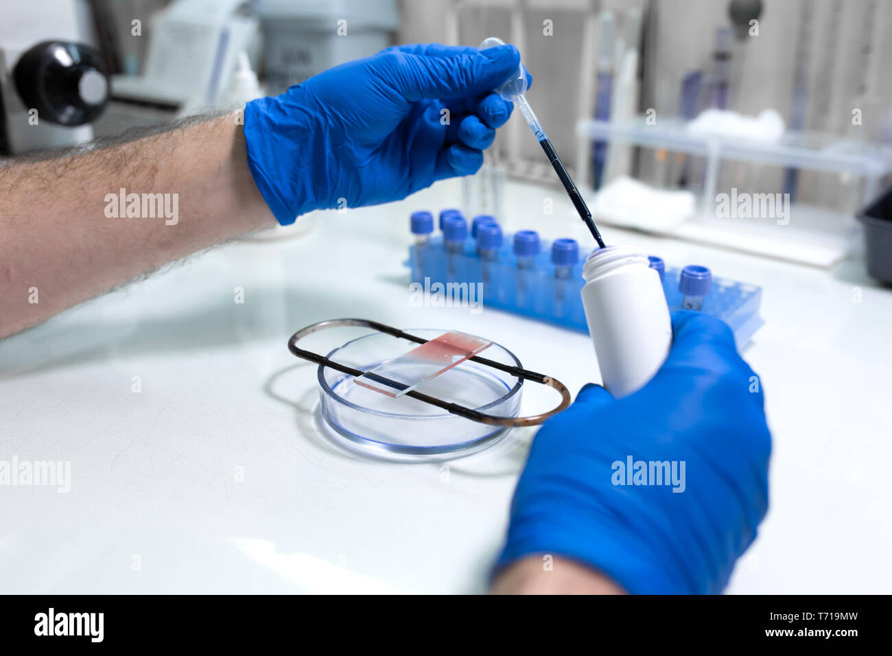 scientist prepare blood sample for research on microscope. Placing
