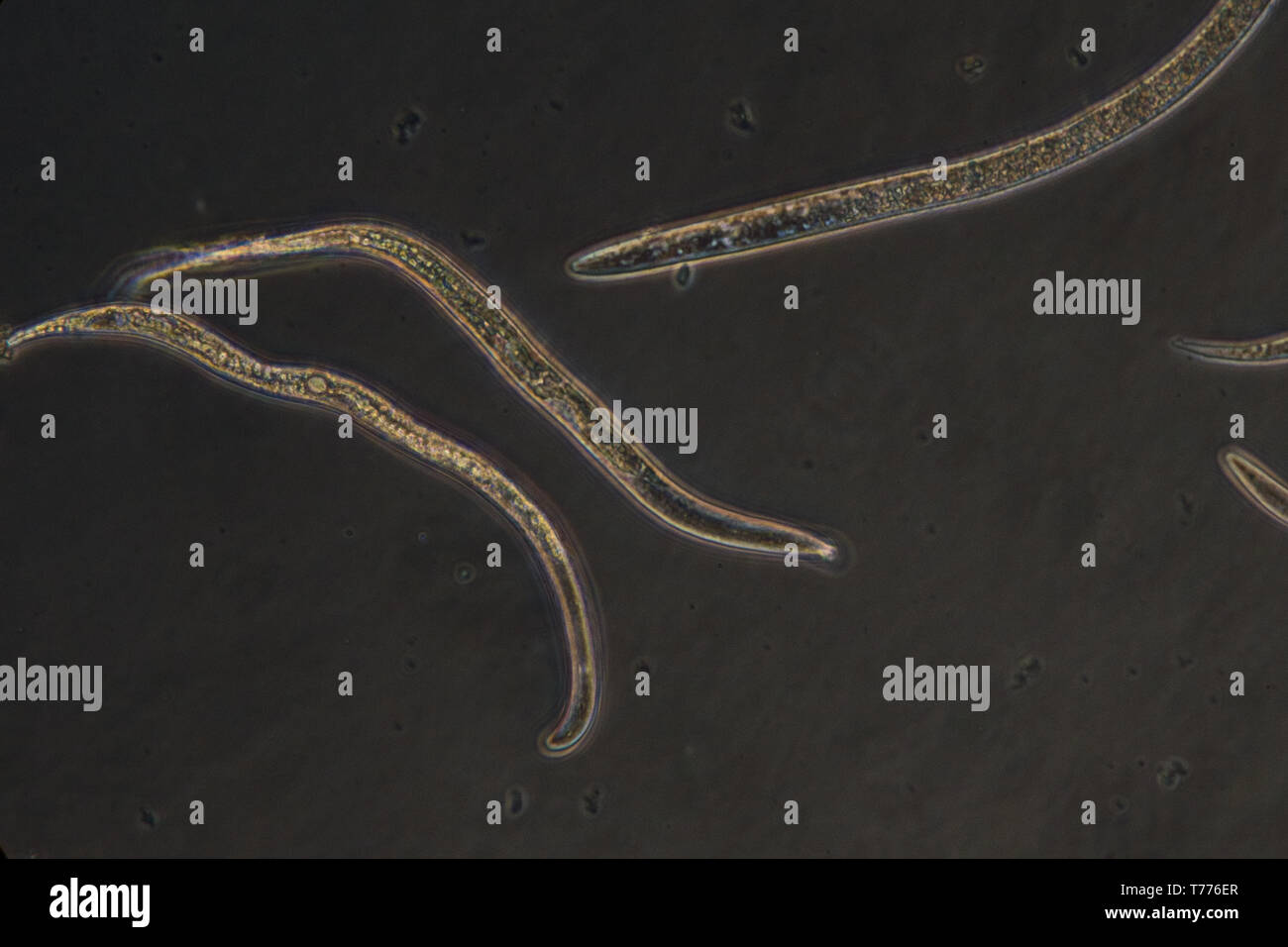 Soil nematode as seen under microscope with bacteria Stock Photo