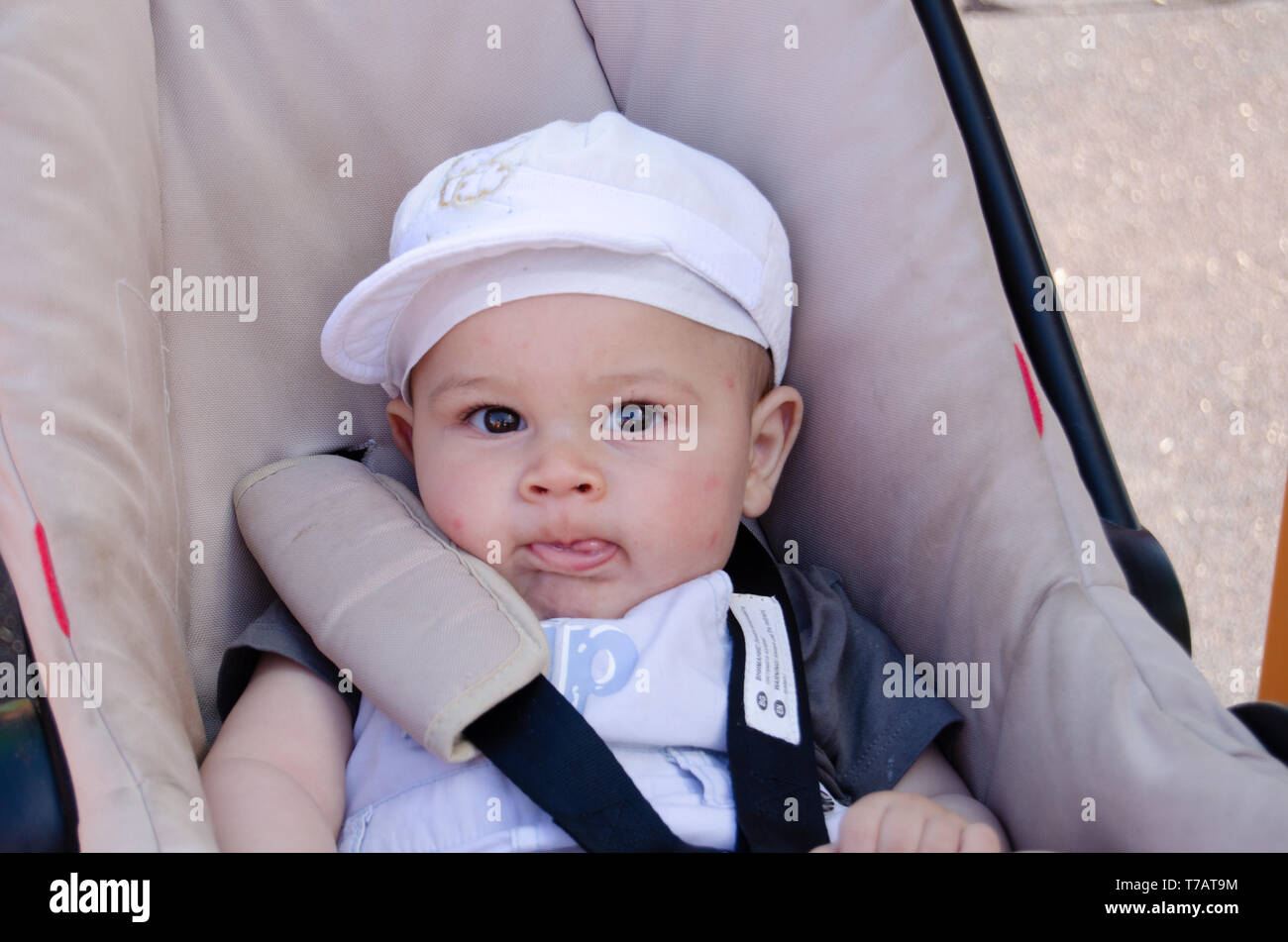 Insect Bites Child High Resolution Stock Photography And Images Alamy Insect Bites Child High Resolution Stock Photography And Images Alamy