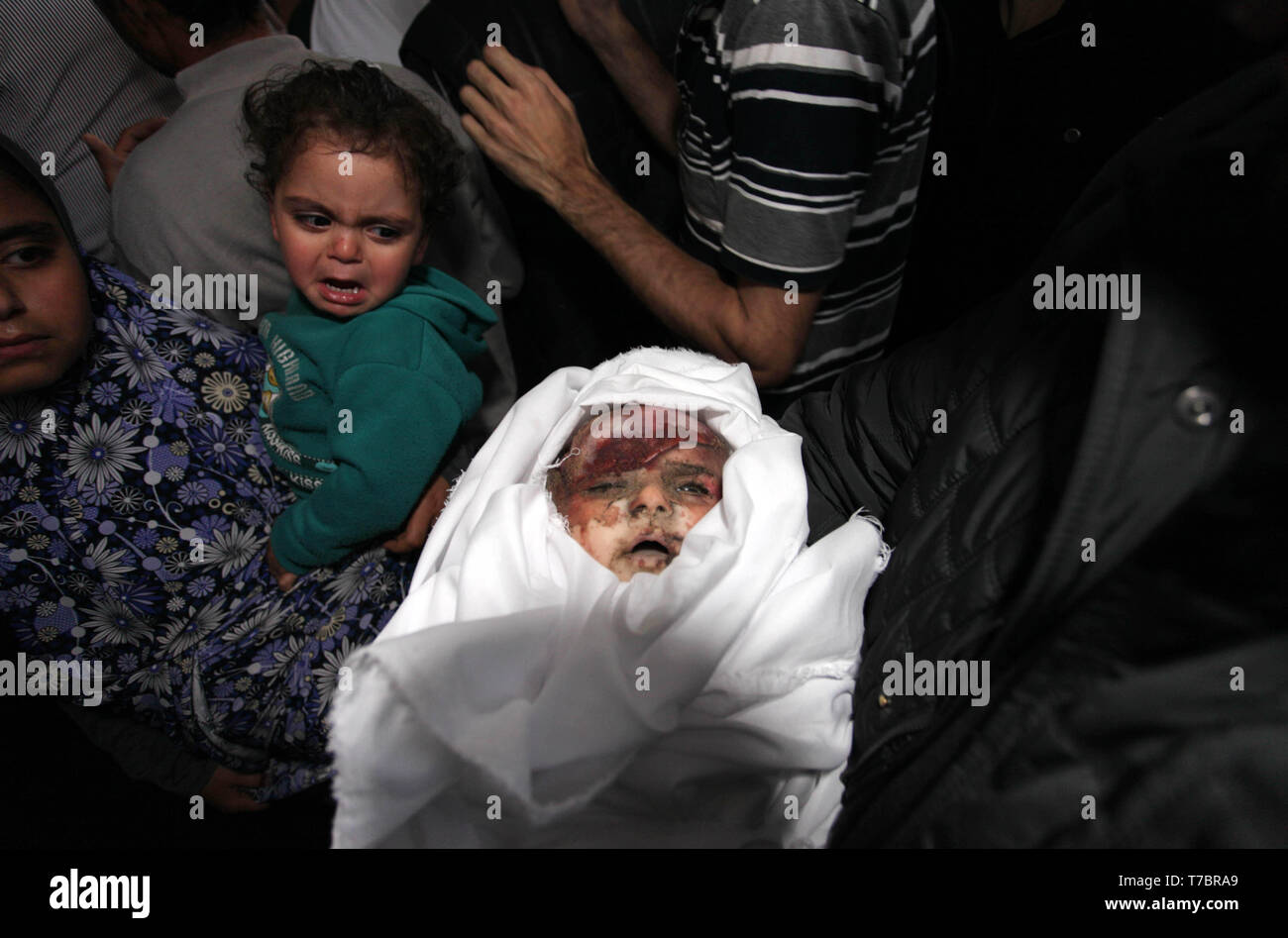 Left Eye Dead Body In Casket