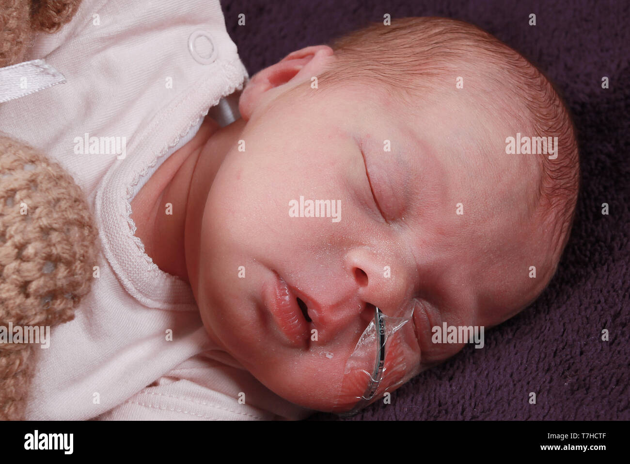 premature baby girl with feeding tube, NG tube Stock Photo