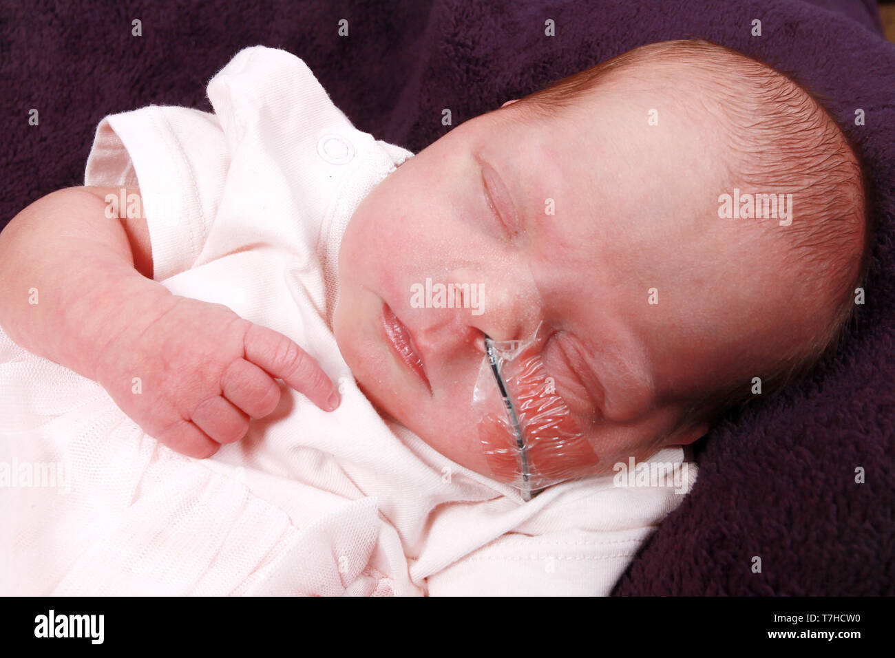 Nasogastric Tube High Resolution Stock Photography and Images Alamy