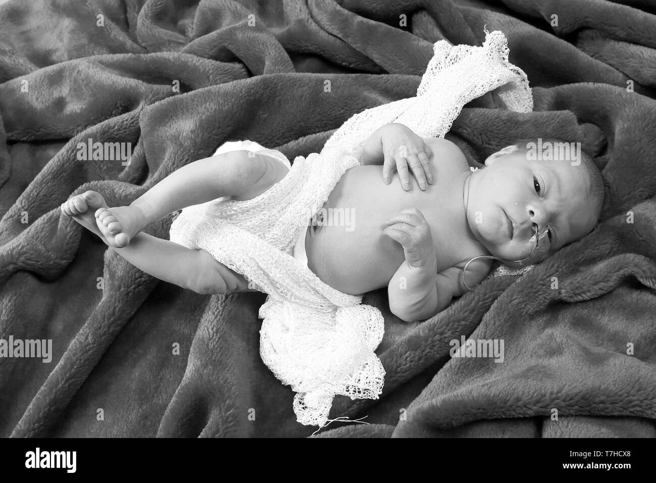 premature baby girl with feeding tube, NG tube Stock Photo