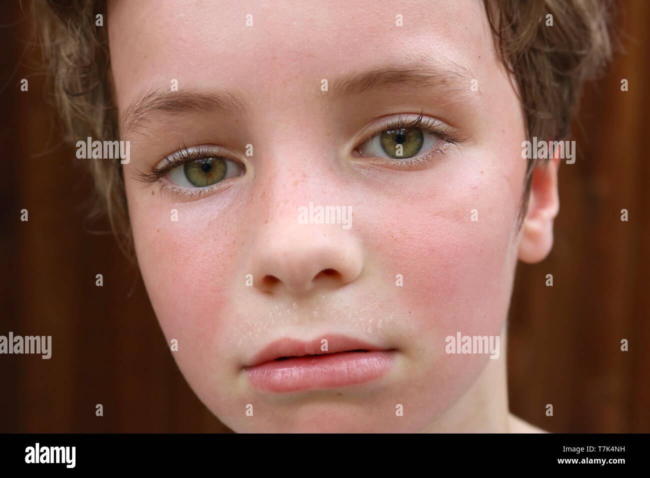 Macro shot of a child's hot face with flushed cheeks and sweat pearls above the lip Stock Photo