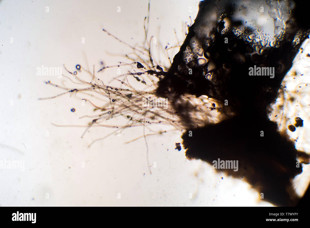 microscopic view of aspergillus mold hyphae Stock Photo