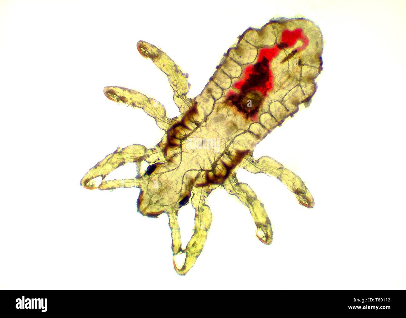 Head Louse - Pediculus capitis, microscope picture, blood inside its body Stock Photo