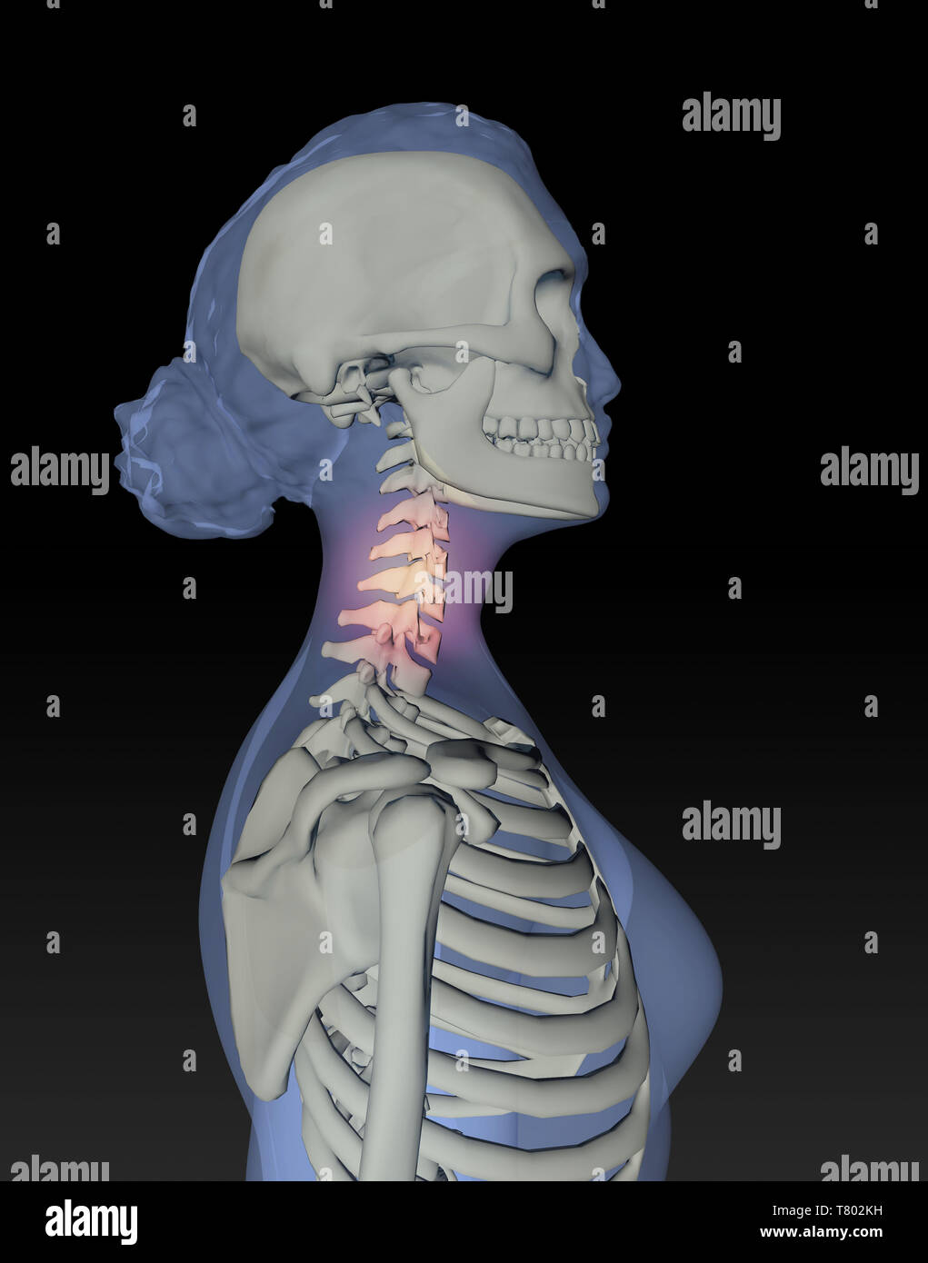 Neck vertebrae drawing hi-res stock photography and images - Alamy