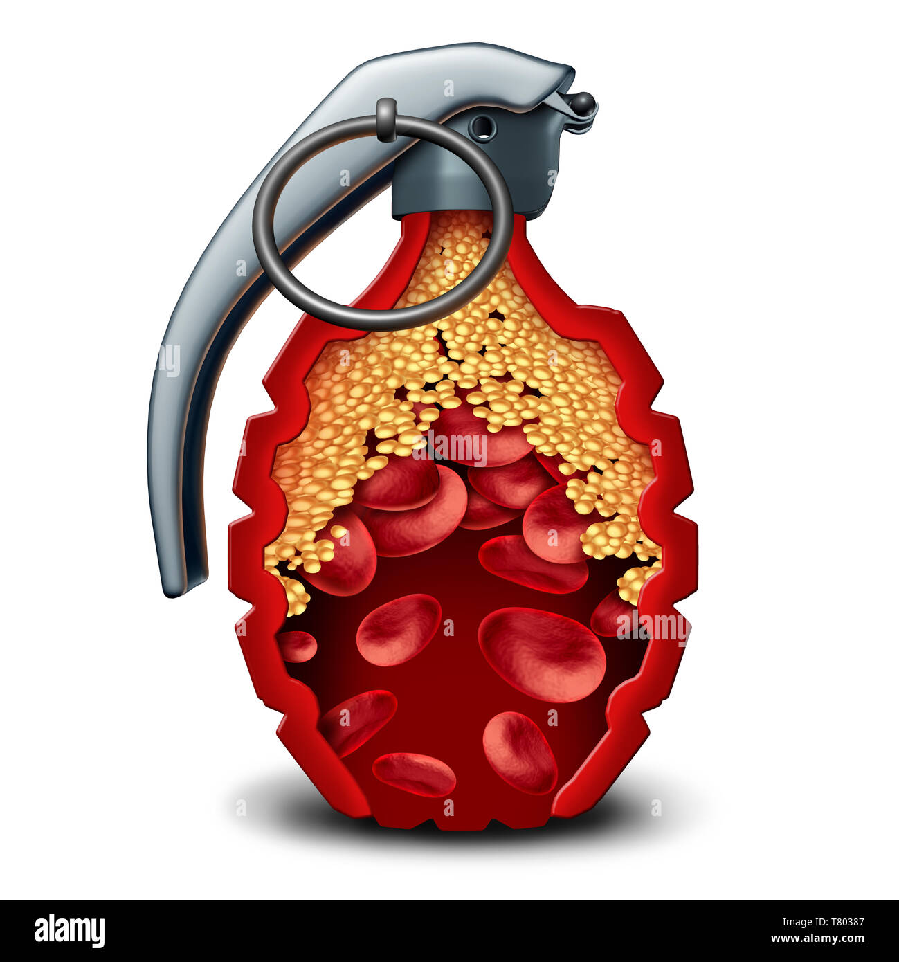 Heart disease bomb and cholesterol danger coronary artery illness as a medical concept with a live grenade inside an artery or vein with plaque. Stock Photo