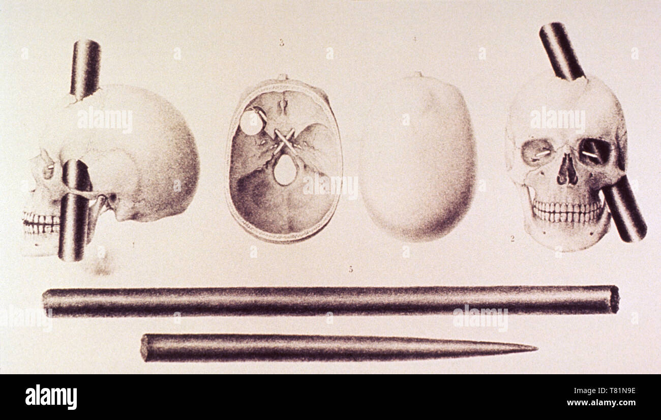 Phineas Gage's skull and iron bar Stock Photo