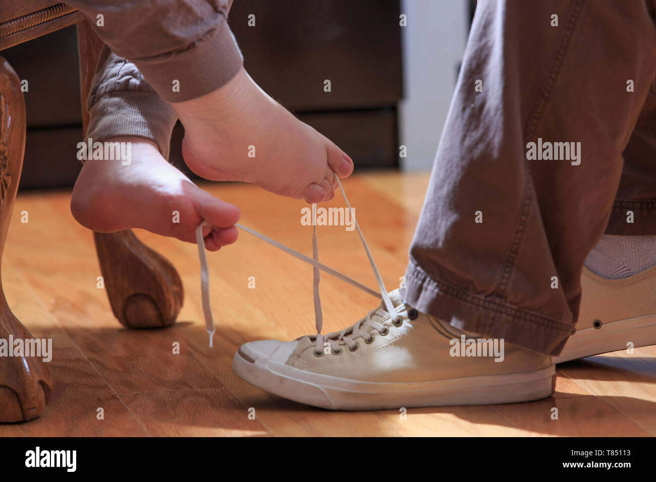 Woman with TAR Syndrome tying her husband's shoe with her feet Stock Photo