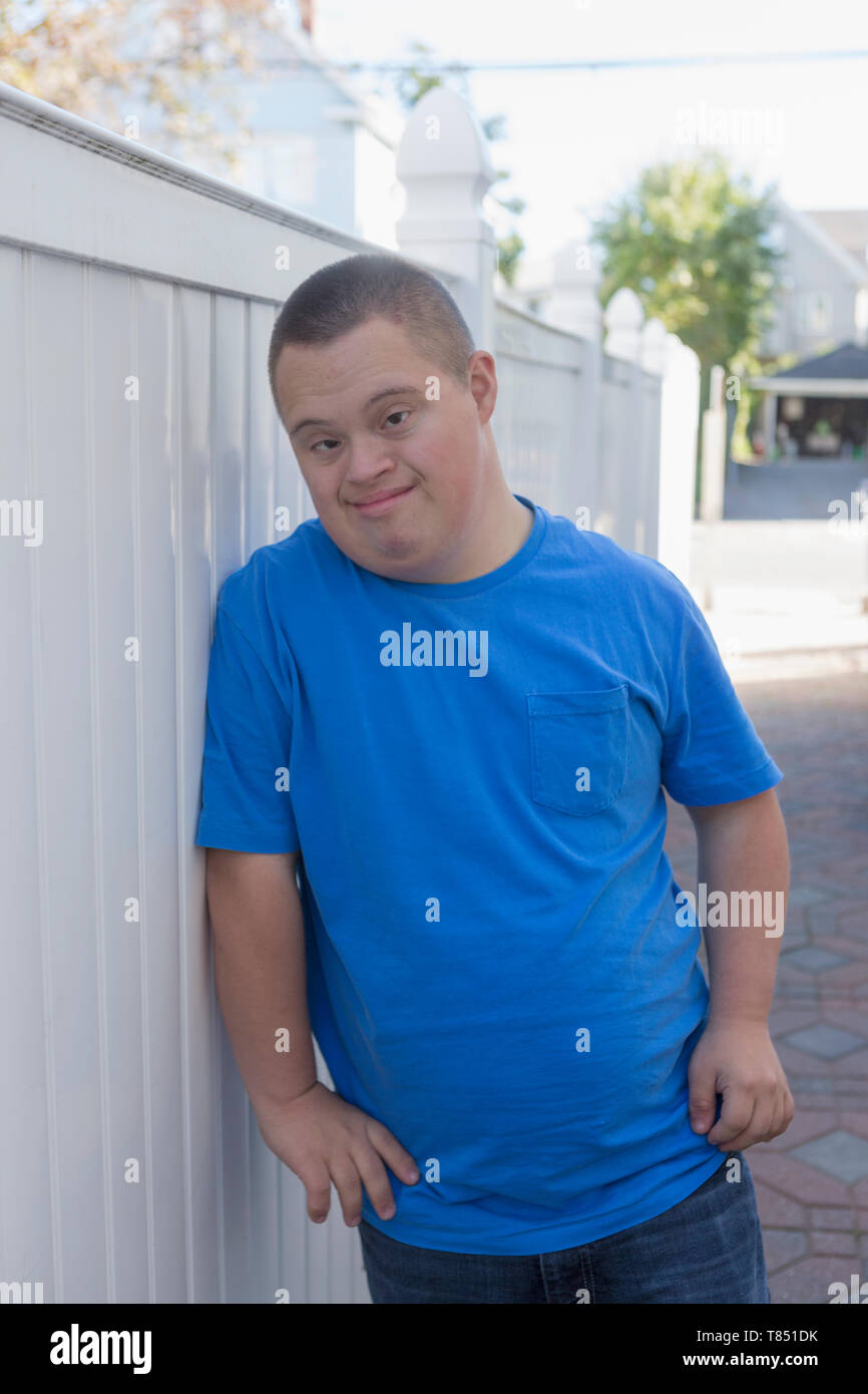 люди дауны. маделин стюарт. даун. синдром дауна фото. подростки с синдромом дауна.