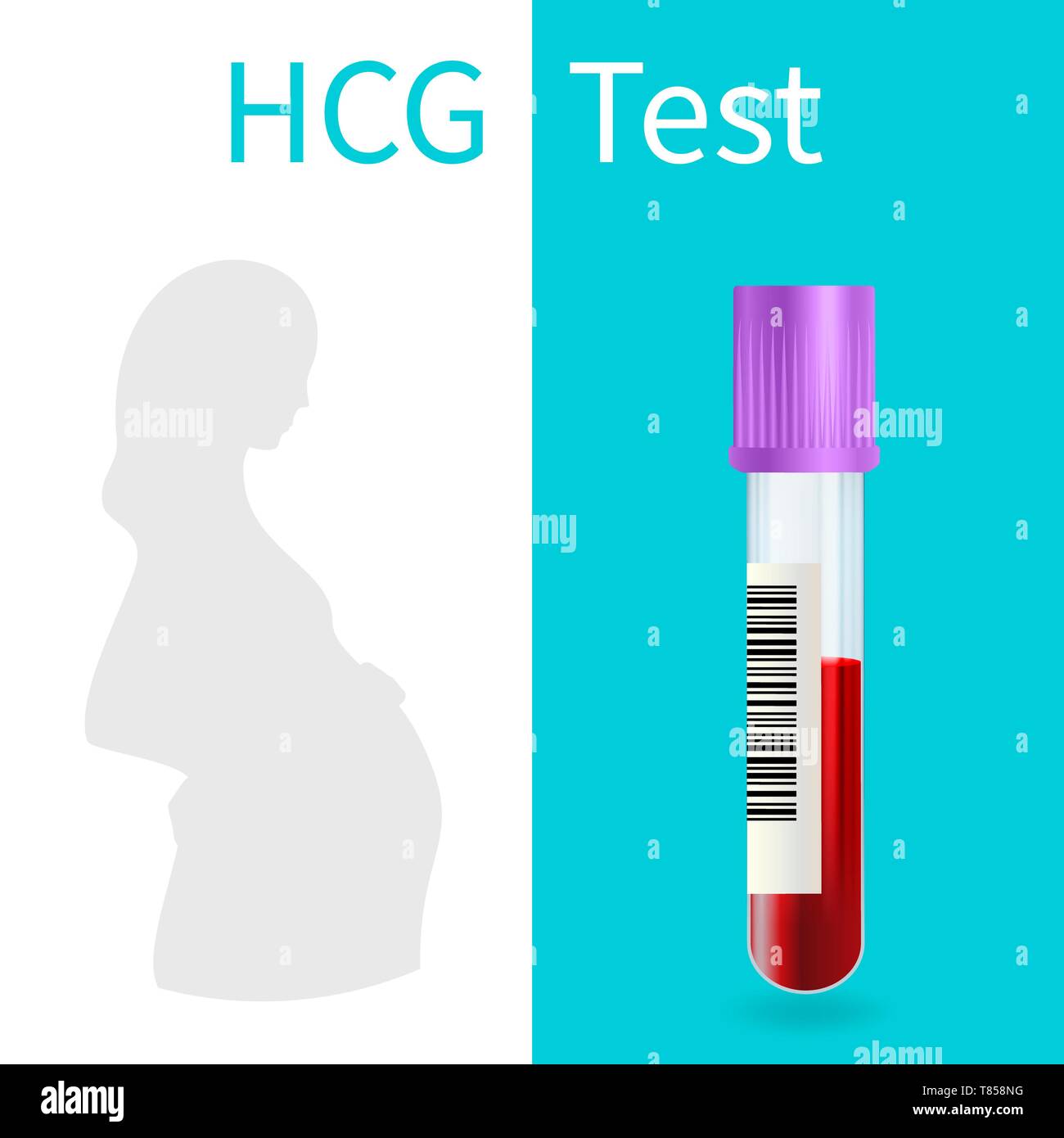 Blood pregnancy test, illustration Stock Photo