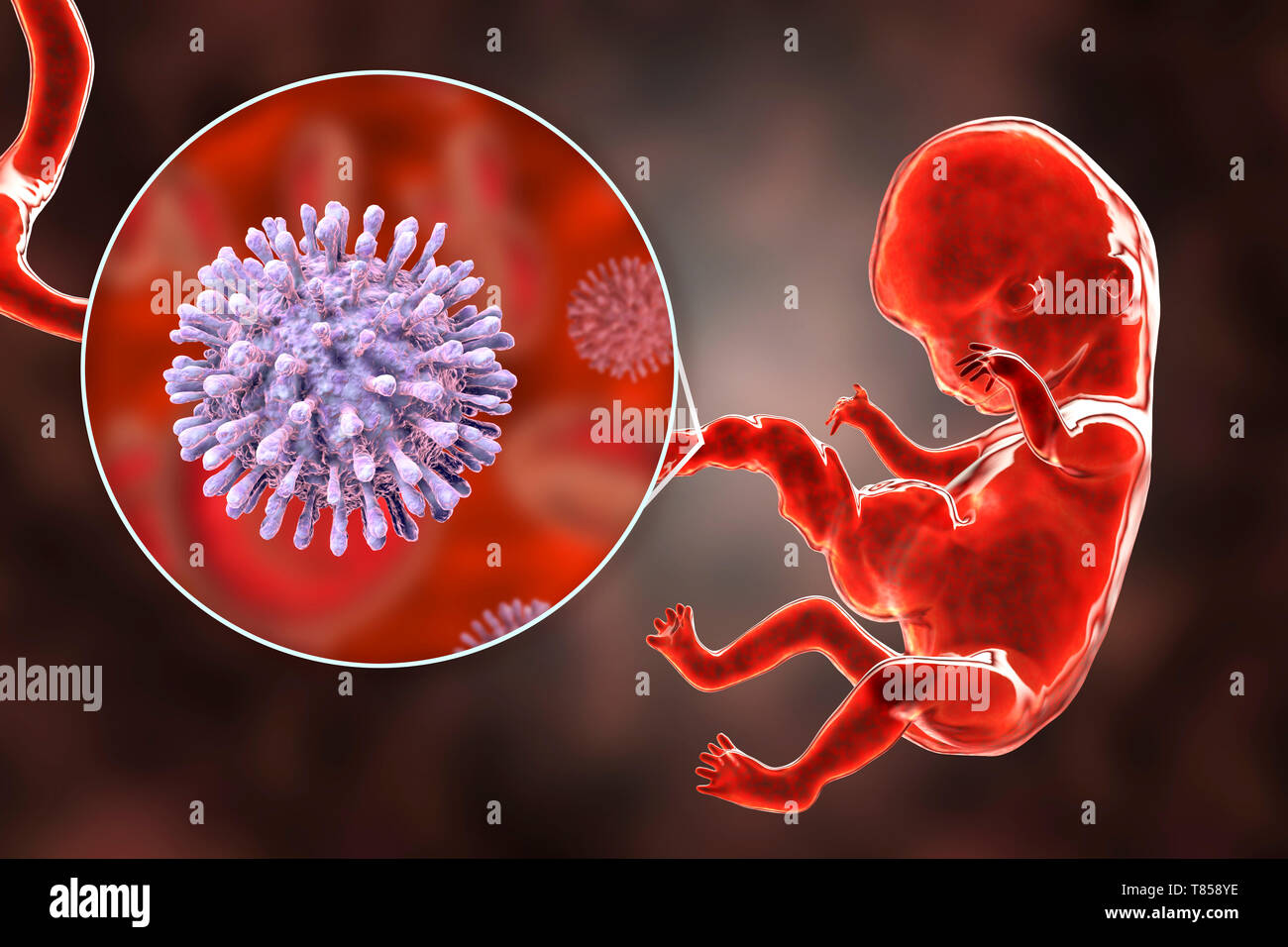 HIV infecting human embryo, illustration Stock Photo