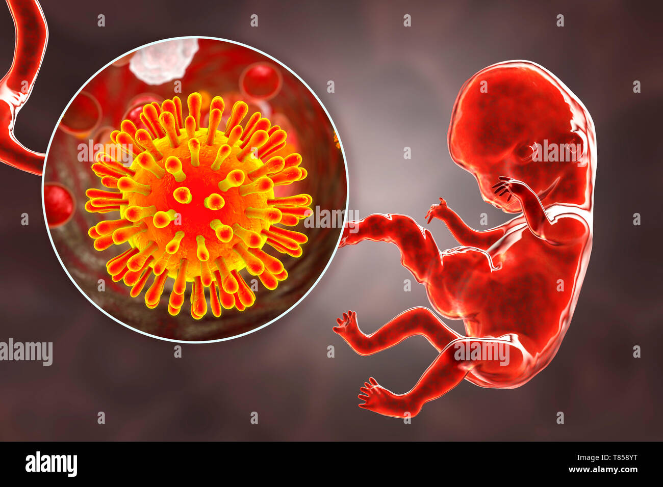 HIV infecting human embryo, illustration Stock Photo