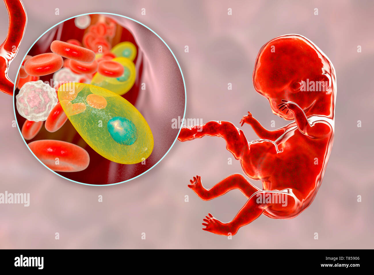 Transplacental transmission of Toxoplasmosis, illustration Stock Photo