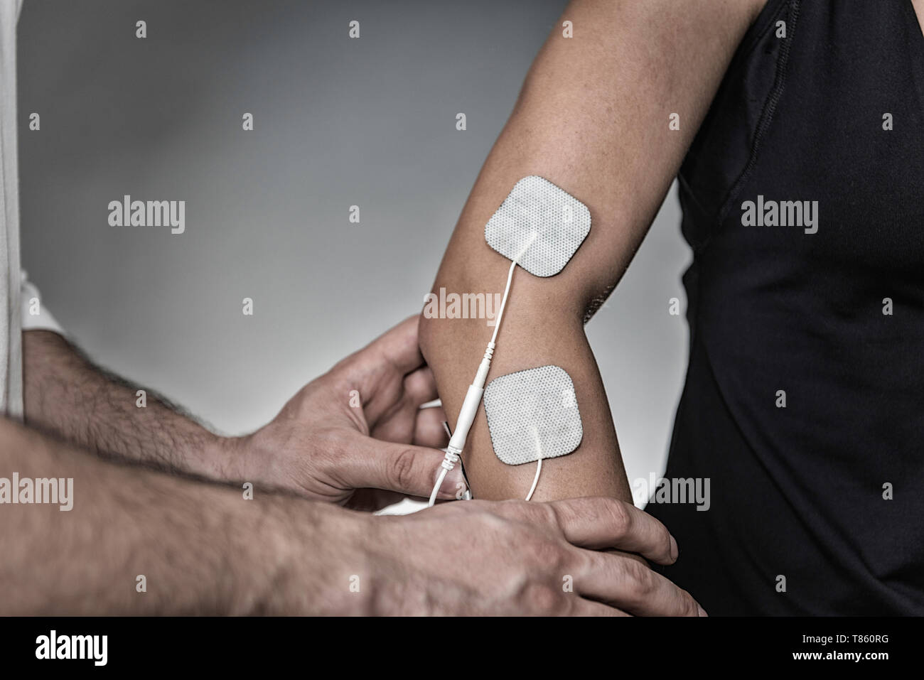 Placing TENS electrodes on arm Stock Photo