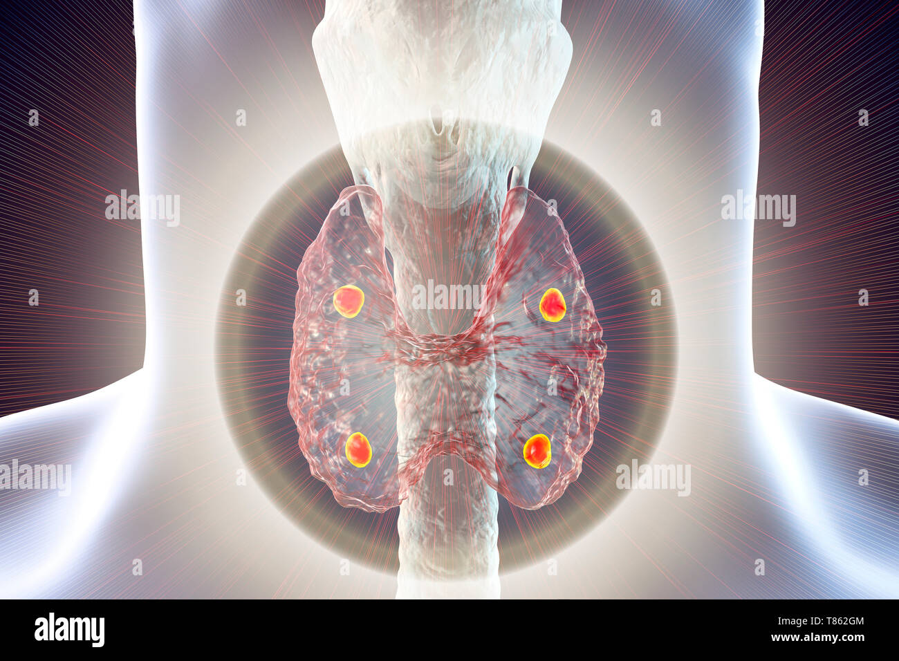 Parathyroid glands, illustration Stock Photo