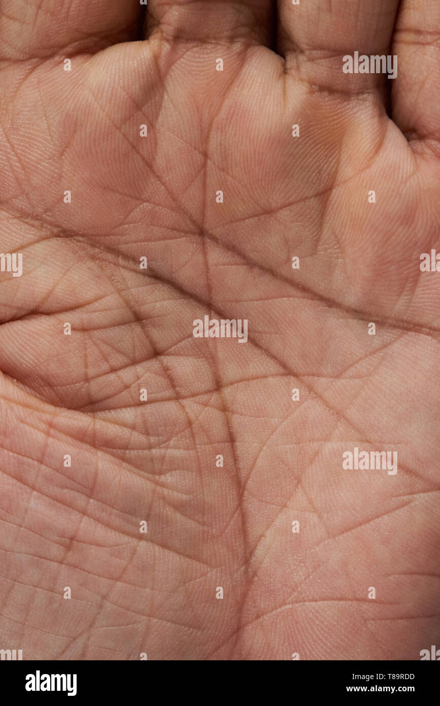 Man palm hand skin texture closeup. Palm hand skin details Stock Photo -  Alamy