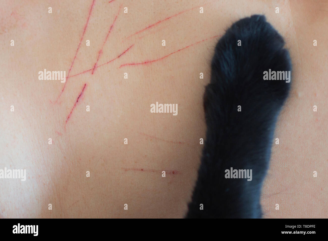 wounds on the skin cat scratches. skin with wounds.irritated skin.care of skin wounds in summer.White background Stock Photo