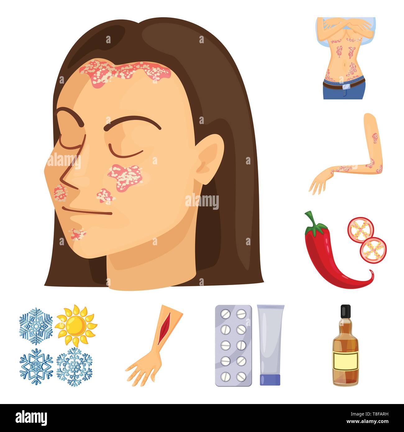 psoriasis,pepper,snowflake,injury,pill,bottle,skin,body,dermatitis ...