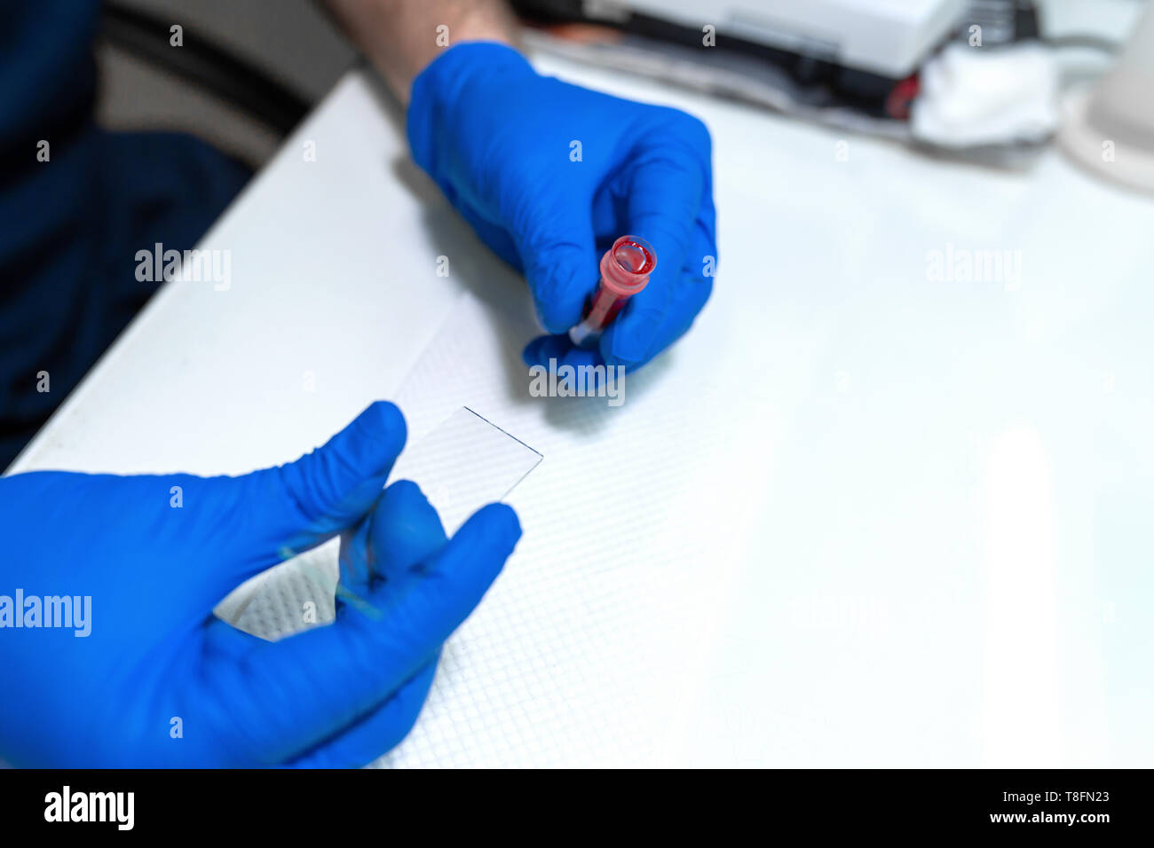 scientist prepare blood sample for research on microscope. Placing