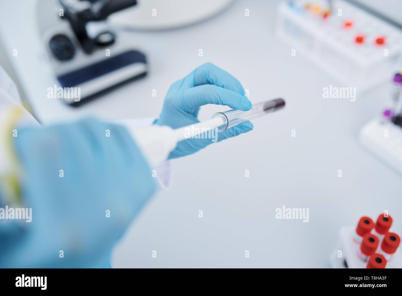 Blood test in laboratory hires stock photography and images Alamy