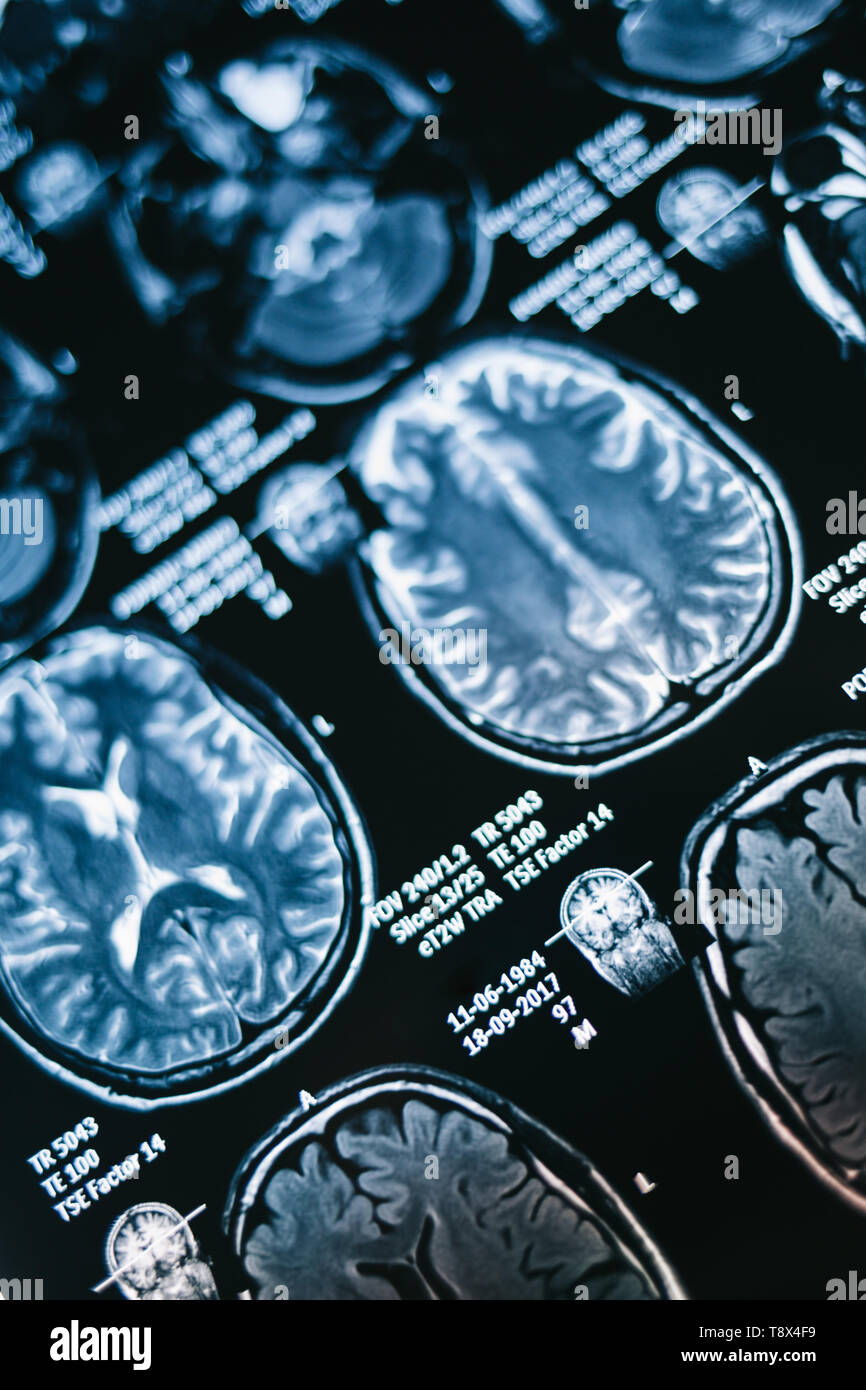 resonance image of head. Xray, MRI, brain, medicine, science