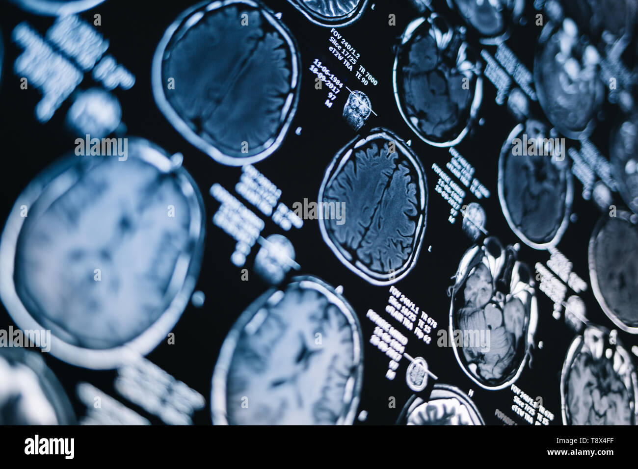 resonance image of head. Xray, MRI, brain, medicine, science