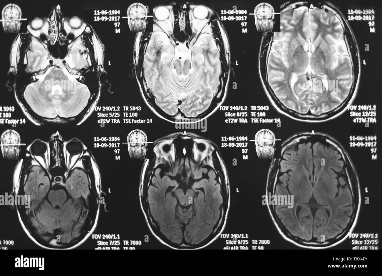resonance image of head. Xray, MRI, brain, medicine, science