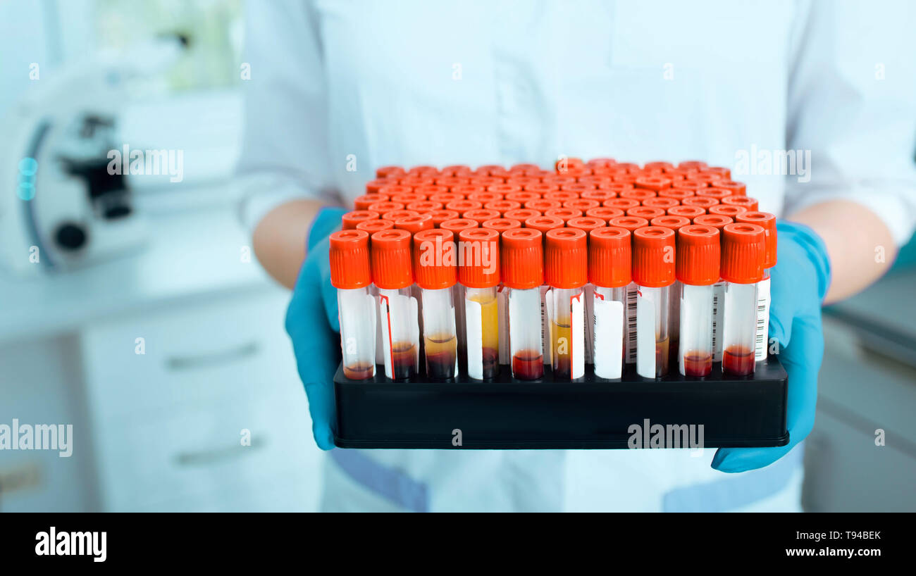 Laboratory scientist holding blood samples in a test tube rack. Blood research Stock Photo