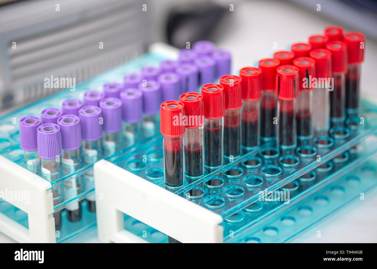 Tubes of blood sample for testing Stock Photo Alamy