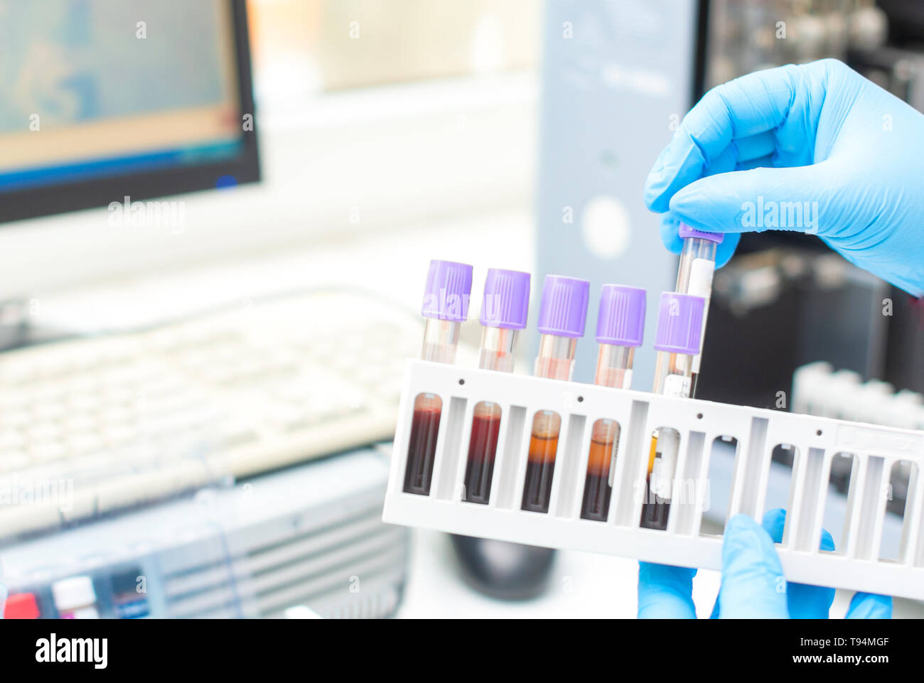 doctor hand taking a blood sample tube from a rack with machines of
