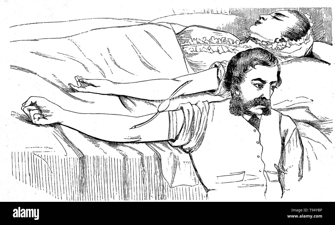 Illustration showing positions of the patient and blood donor, by J. H. Aveling, published in Obstetrics Journal, 1873. Stock Photo