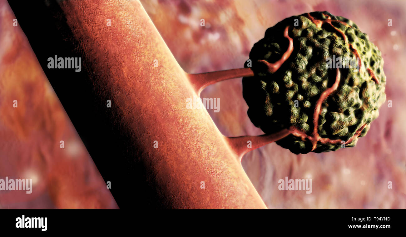 Illustration of a cancer cell. Cancer cells are cells that grow and divide at a quickened pace. They become malignant when the other cells fail to recognize and destroy them. Stock Photo