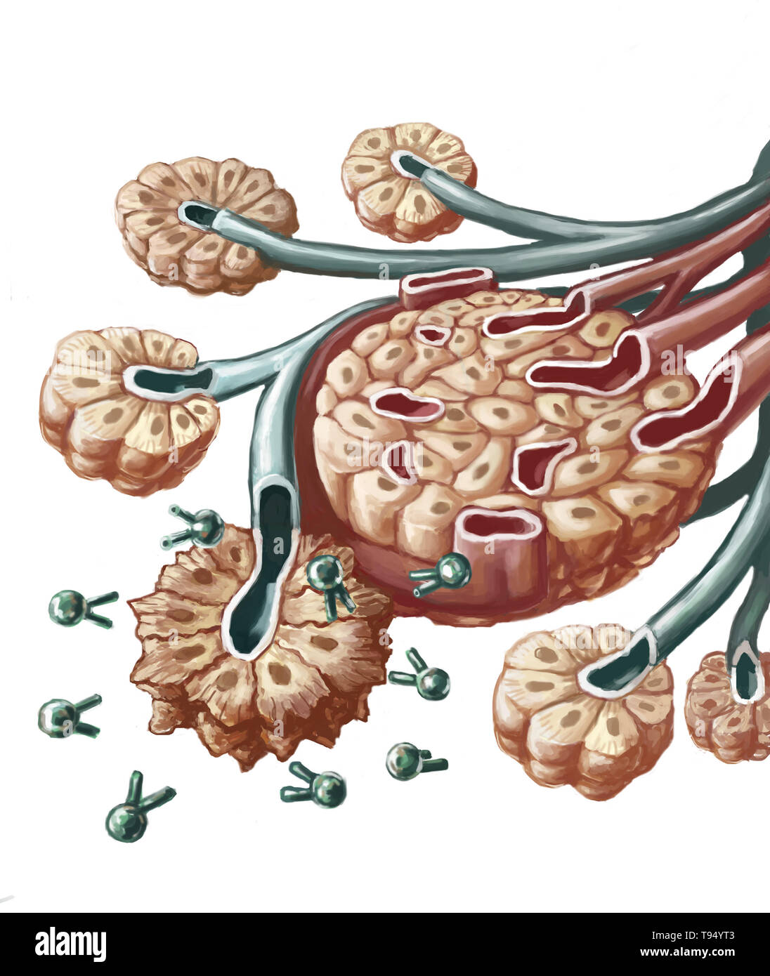 Illustration of radioimmunotherapy used to treat pancreatic cancer. A radioactive isotope (lead-212) is combined with a specific antibody capable of targeting cancerous cells. This combination of antibody and lead-212 radioisotope is injected intravenously into the body until it reaches the pancreas where it locks onto the cancerous cells' antigen. The lead destroys the cells by irradiating them. This treatment limits the toxicity on healthy cells located near the cancerous cells. Stock Photo