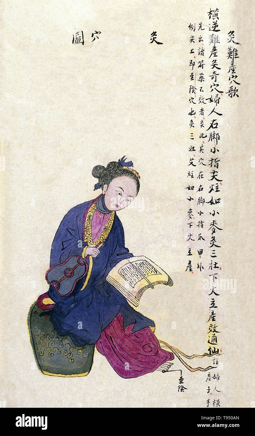 Acu-moxa point chart, showing the zhiyin (Reaching Yin) point, here also described as the 'difficult birth' point, from Chuanwu lingji lu (Record of Sovereign Teachings), by Zhang Youheng, a treatise on acu-moxa in two volumes. This work survives only in a manuscript draft, completed in 1869 (8th year of the Tongzhi reign period of the Qing dynasty). The text states: The zhiyin point is located on the outer side of the little toe beside the corner of the toenail. This point is moxibusted with three moxa cones, the size of a grain of wheat. It can cure severe complications of childbirth. Stock Photo