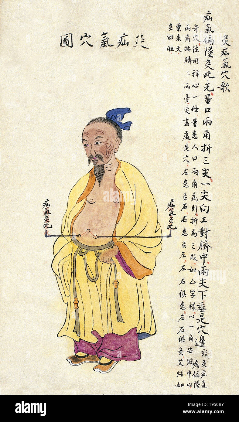 Acu-moxa point chart, showing the hernia (shanqi) point, from Chuanwu lingji lu (Record of Sovereign Teachings), by Zhang Youheng, a treatise on acu-moxa in two volumes. This work survives only in a manuscript draft, completed in 1869 (8th year of the Tongzhi reign period of the Qing dynasty). The text states: To locate the hernia point, measure the width of the patient's mouth from corner to corner, and multiply this measurement by three. Stock Photo