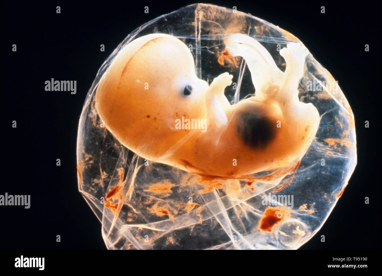 Human fetus in membrane at 6 weeks. Eye and limbs visible. Focus is on organ differentiation at this stage. Subsequent stages of development focus shifts to growthg of fetus. Stock Photo