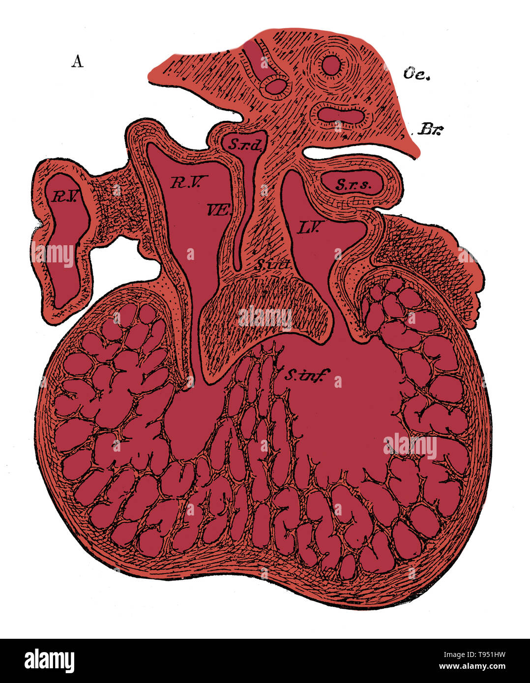 Section through the heart of human embryo showing the formation of the cardiac septa and the auriculo-ventricular valves, 5 to 6 weeks. R.V, right auricle; L.V, left auricle; S.r.d, right horn of sinus; Sr.s, left horn of sinus; s. int, septum superior and endocardial cushion (septum intermedium); s. inf, septum infers ventriculorum; This septum, as well as the bulk of the ventricle, is a muscular sponge at this stage. Oc, esophagus; Br, bronchus. Stock Photo