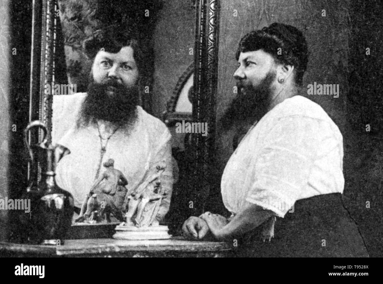 Clémentine Clatteaux Delait (March 5, 1865 - Apri 5, 1939) was a French bearded lady. Her facial hair began growing while she was a teenager. In 1885, she married a local baker, changed her name to Delait and opened a café and bakery in the village of Taon-les-Vosges. Until that point Clementine had shaved off her beard every day, but while working at the café she made a bet with a customer to let it grow. Stock Photo